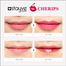 画像5: Stayve Cherips Micro-needling Ampoules Set for Lips  ステイヴ チェリップス リップ用 カラー材 (5)