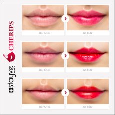 画像6: Stayve Cherips Micro-needling Ampoules Set for Lips  ステイヴ チェリップス リップ用 カラー材 (6)